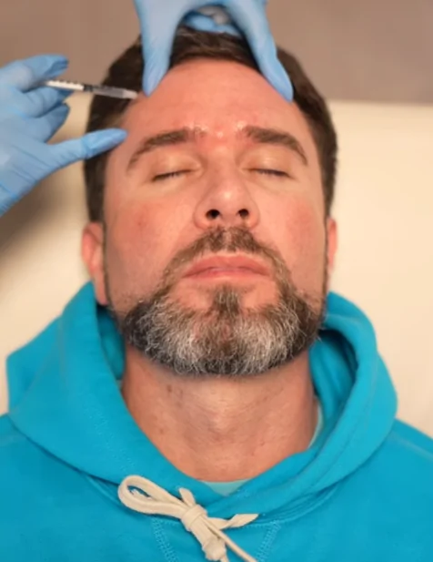 Male patient receiving dermal fillers to enhance facial structure and reduce forehead lines.