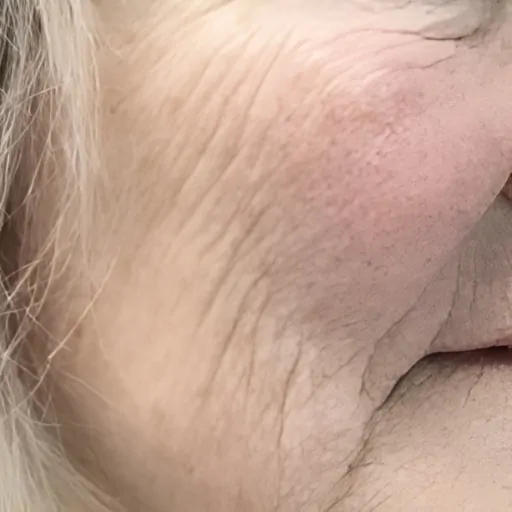 Polynucleotides for Aging Before