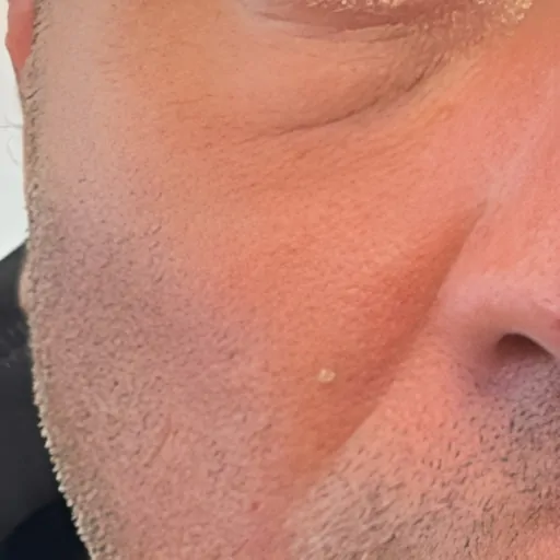 Polynucleotides for Men After 2