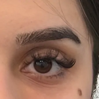 Polynucleotides for Under Eyes After