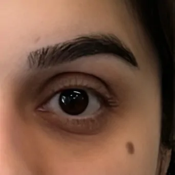 Polynucleotides for Under Eyes Before