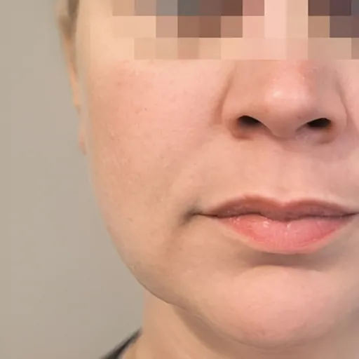 Mummy makeover after